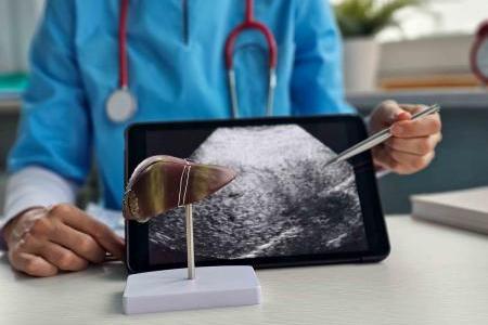 Cancer du foie : améliorer l'accès aux soins de to
