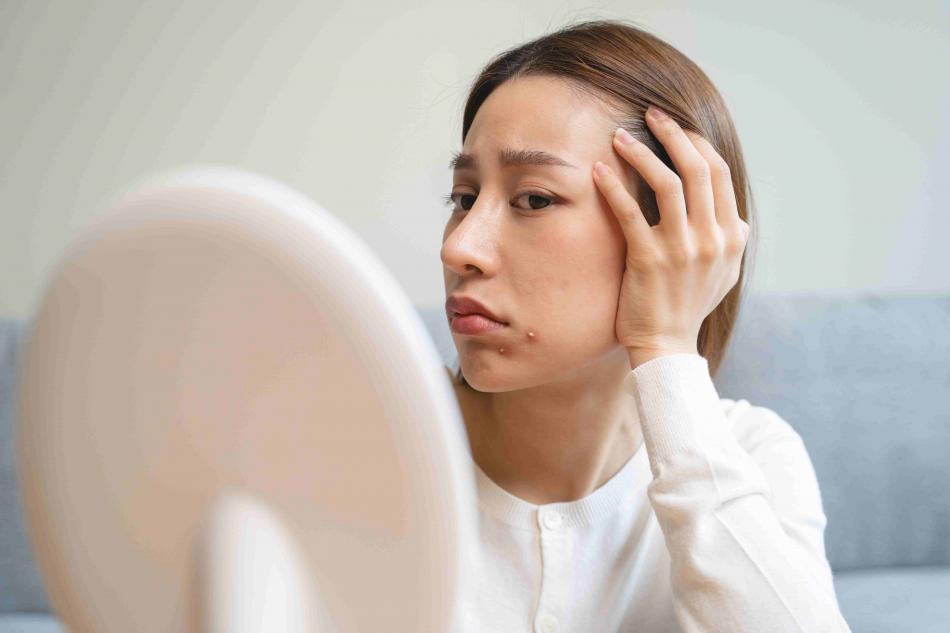 Conseils dermato et réseaux sociaux : les professi