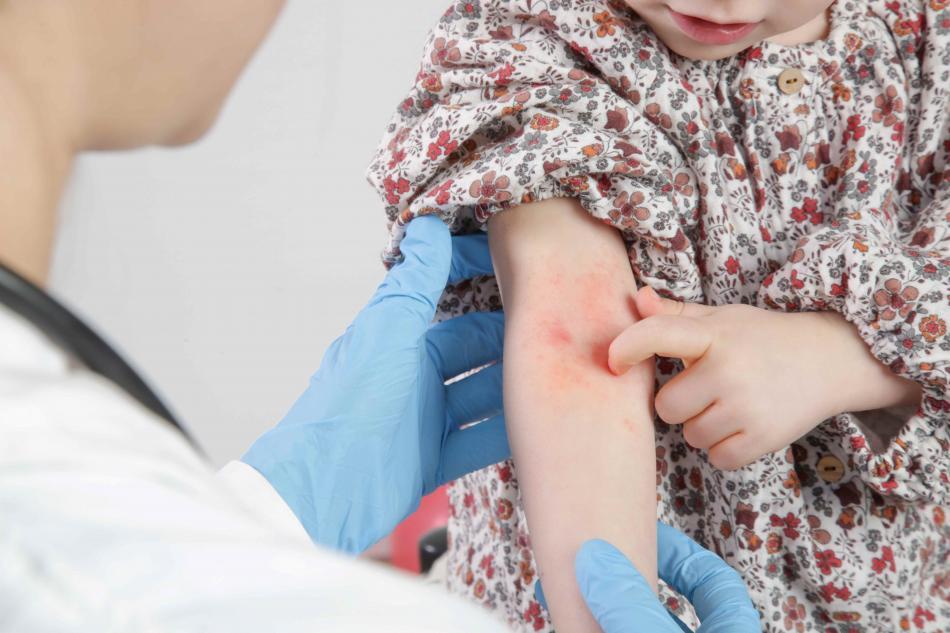 Eczéma : mieux en comprendre les contraintes
