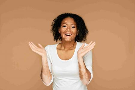 Le premier traitement contre le vitiligo arrive en