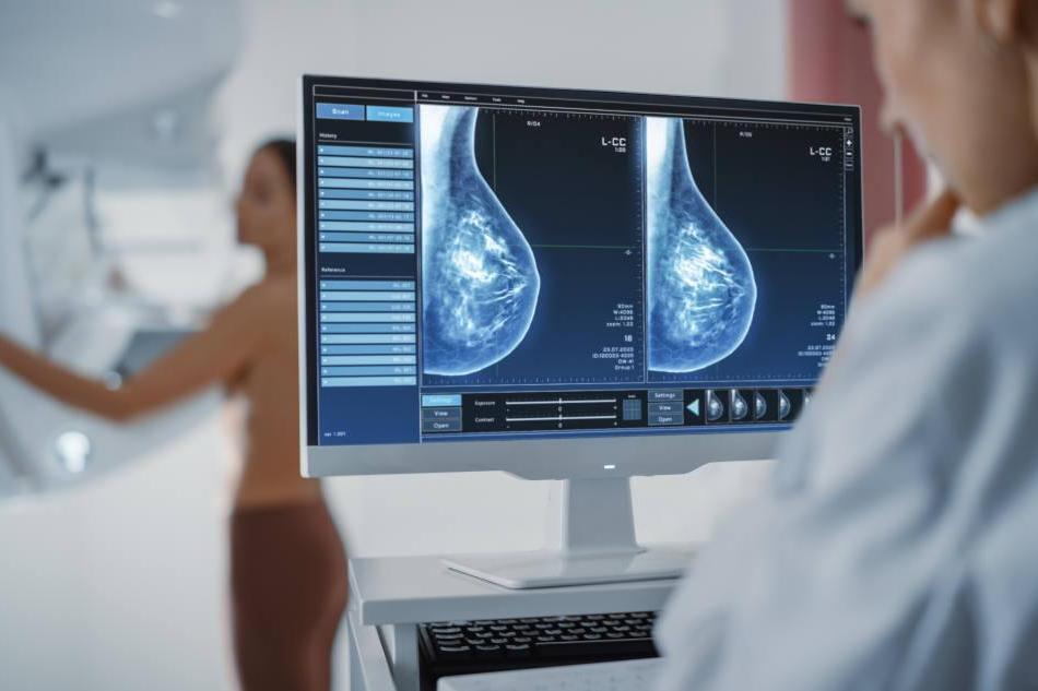 Mammographie : la HAS veut intégrer de la 3D