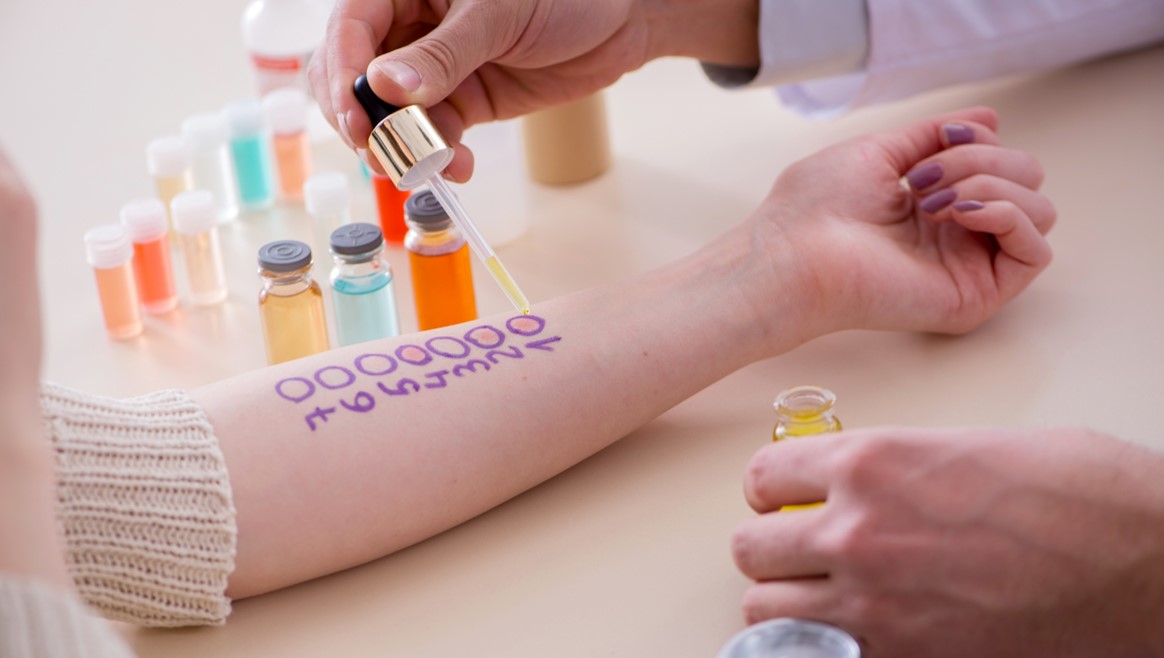 Allergies respiratoires, alimentaires et croisées